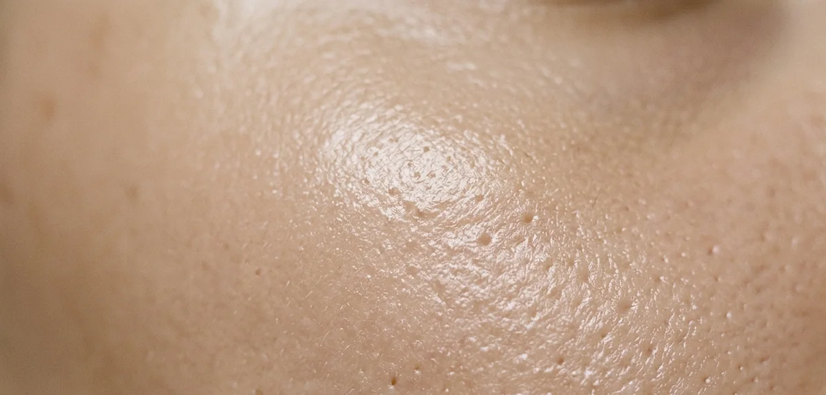 Pori dilatati: come ridurli davvero (senza credere ai miti)